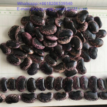 Health Food Top Quality Large Light Speckled Kidney Bean
